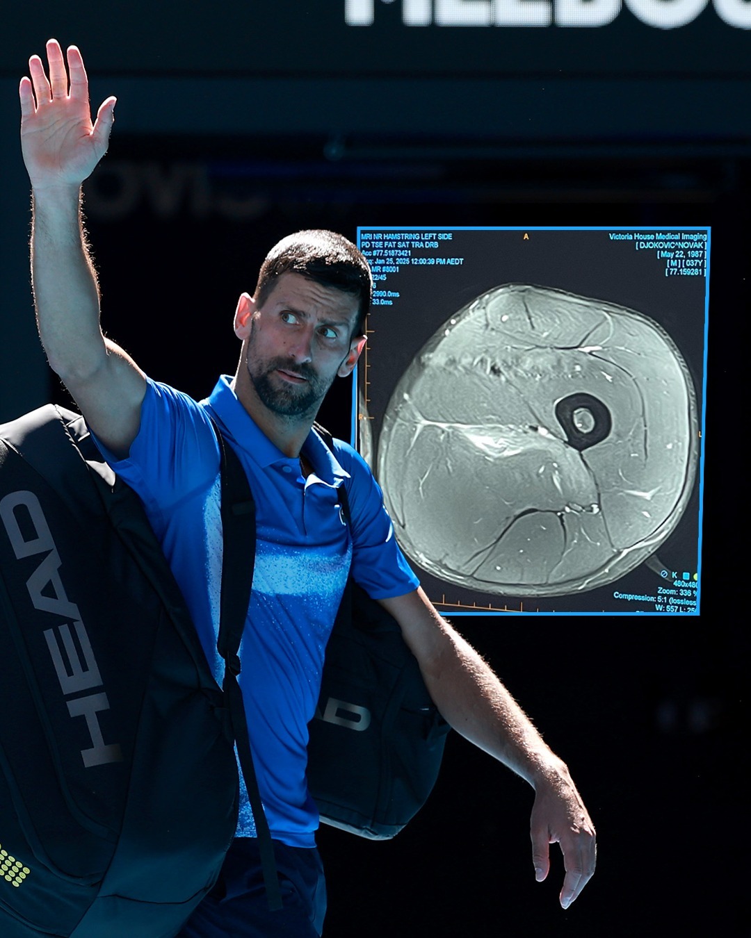 意大利网球队逆转欧洲网球队，德约科维奇送出助攻的简单介绍